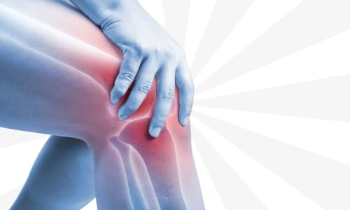 Arsitektur Gerak: Mengenal Komponen Utama yang Membangun Persendian Manusia